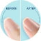 Scholl Velvet Smooth Electronic Nail Care System - Kit Elettronico Per La Cura Delle Unghie