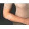 Nexcare Cerotti Per Sutura Steristrip - Cerotti Da 6 x 75 mm + 3 x 75 mm