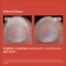 Isdin Si Nails - Penna Rinforzante Per Unghie 2,5 ml