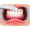Aminogam 15 ml - Gel per il tessuto orogengivale