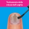 Excilor Forte 30 ml - Per il trattamento della Micosi all'Unghia