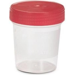 Gamma Test - Contenitore Test Urine 100 ml