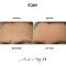 Patch Microaghi Fronte - 1 Maschera Viso