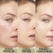 Prime Lab 24H Redness Eraser - Primer Anti-Rossore 30 ml