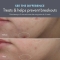Clear Improvement Blemish Clearing Hydrating Lotion - Lozione Idratante Anti-Imperfezioni 50 ml