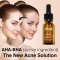 SKIN LABO Shot Concentrato Aha + Bha - Siero viso esfoliante 15 ml
