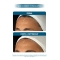 Miamo Poli-Hyaluronic 14+ Fusion Cream - Crema Antirughe Volumizzante 50 ml