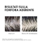 VICHY Dercos Shampoo trattante Anti-forfora DS per capelli da normali a grassi 200 ml
