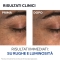 Uriage Age Absolu Balsamo Contorno Occhi anti-età 15 ml