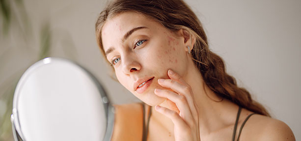 Categoria-Cura della Pelle e Lesioni - Acne