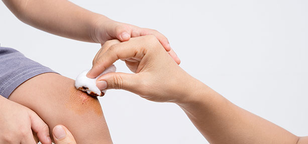 Categoria-Cura della Pelle e Lesioni - Disinfettanti e Antisettici