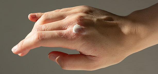 Categoria-Cura della Pelle e Lesioni - Eczema e Infiammazioni