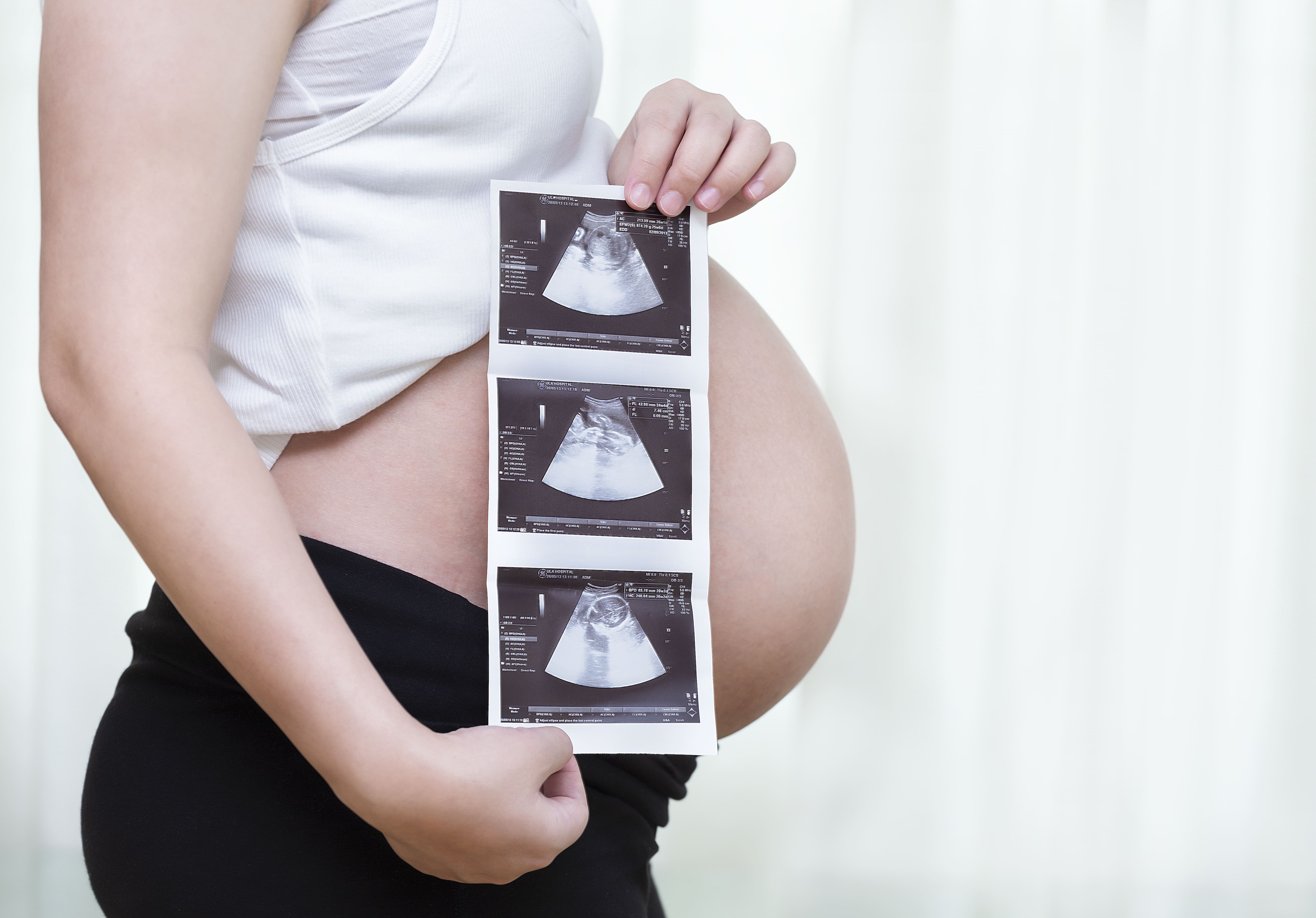 Parto naturale o cesareo? Tutti i pro e i contro